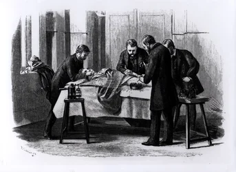 Antiseptic Surgery, 1882